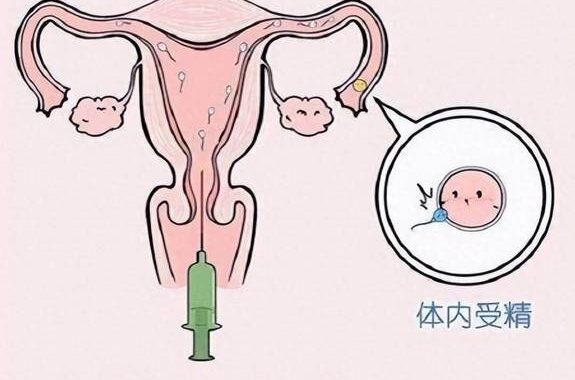 女性生殖器官详解与保健指南